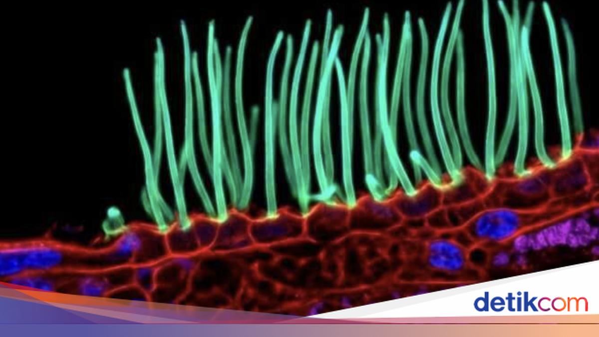 Dugaan Penggunaan AI Guncang Kontes Fotografi Ilmiah Bergengsi — gambar dari Detik Inet