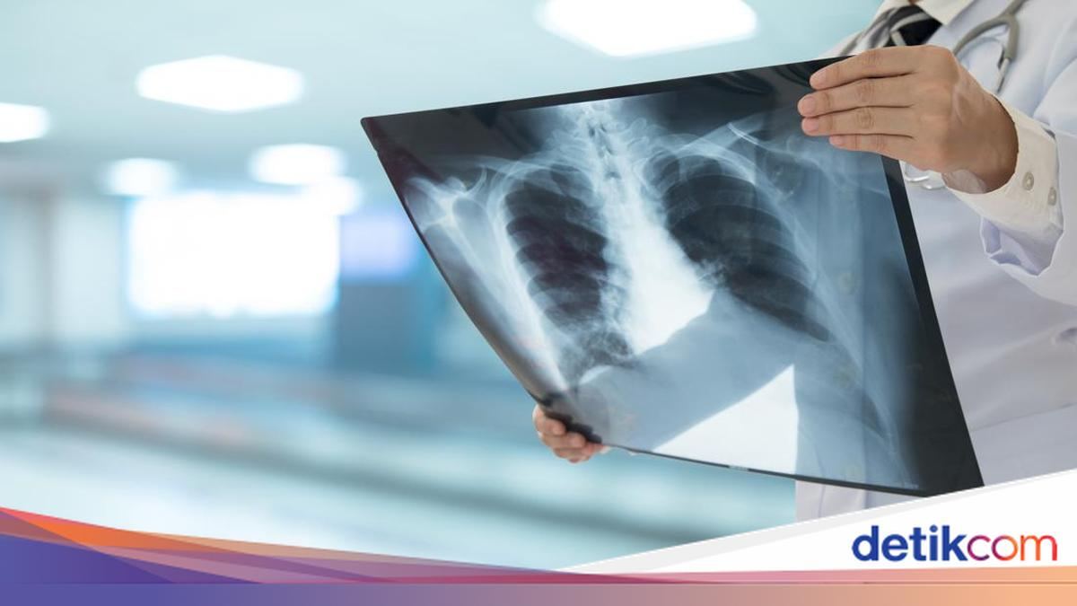 'Peramal COVID' Sebut Pes Paru Siberia, Seberapa Berbahaya Penyakit Ini? — gambar dari Detik Inet